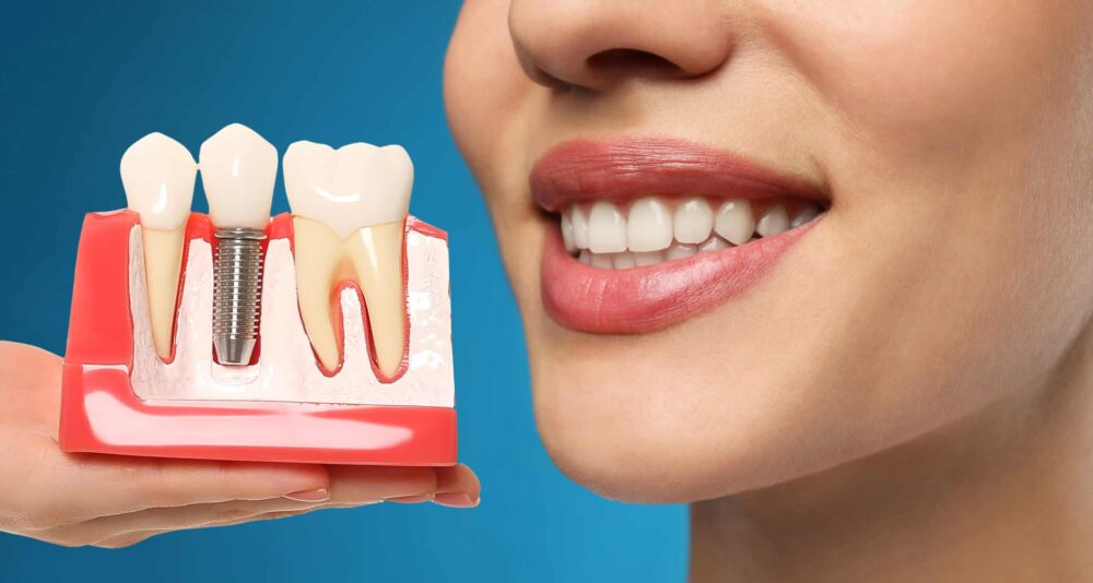 Dental Implants Centennial